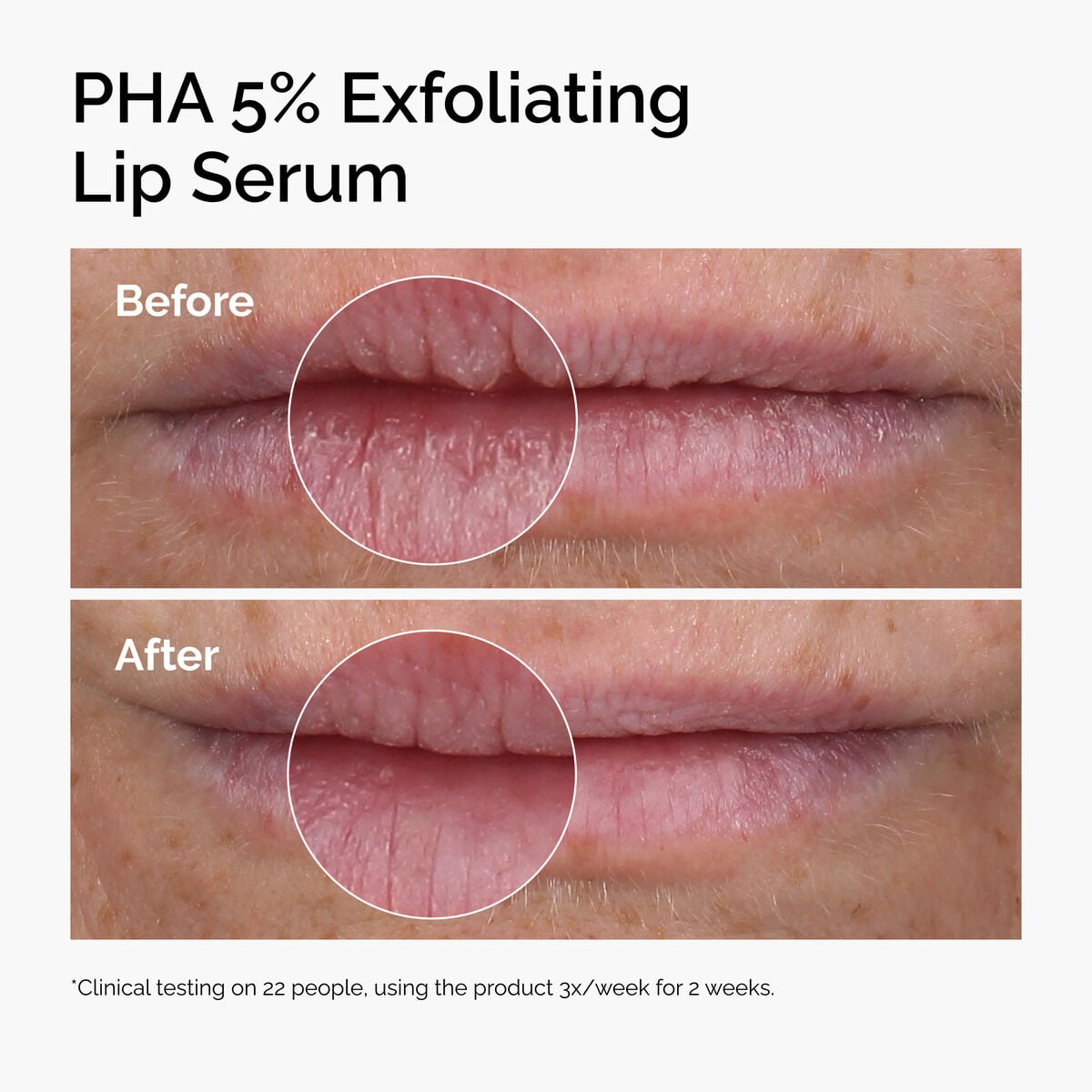 PHA 5% Gentle Exfoliating Lip Serum