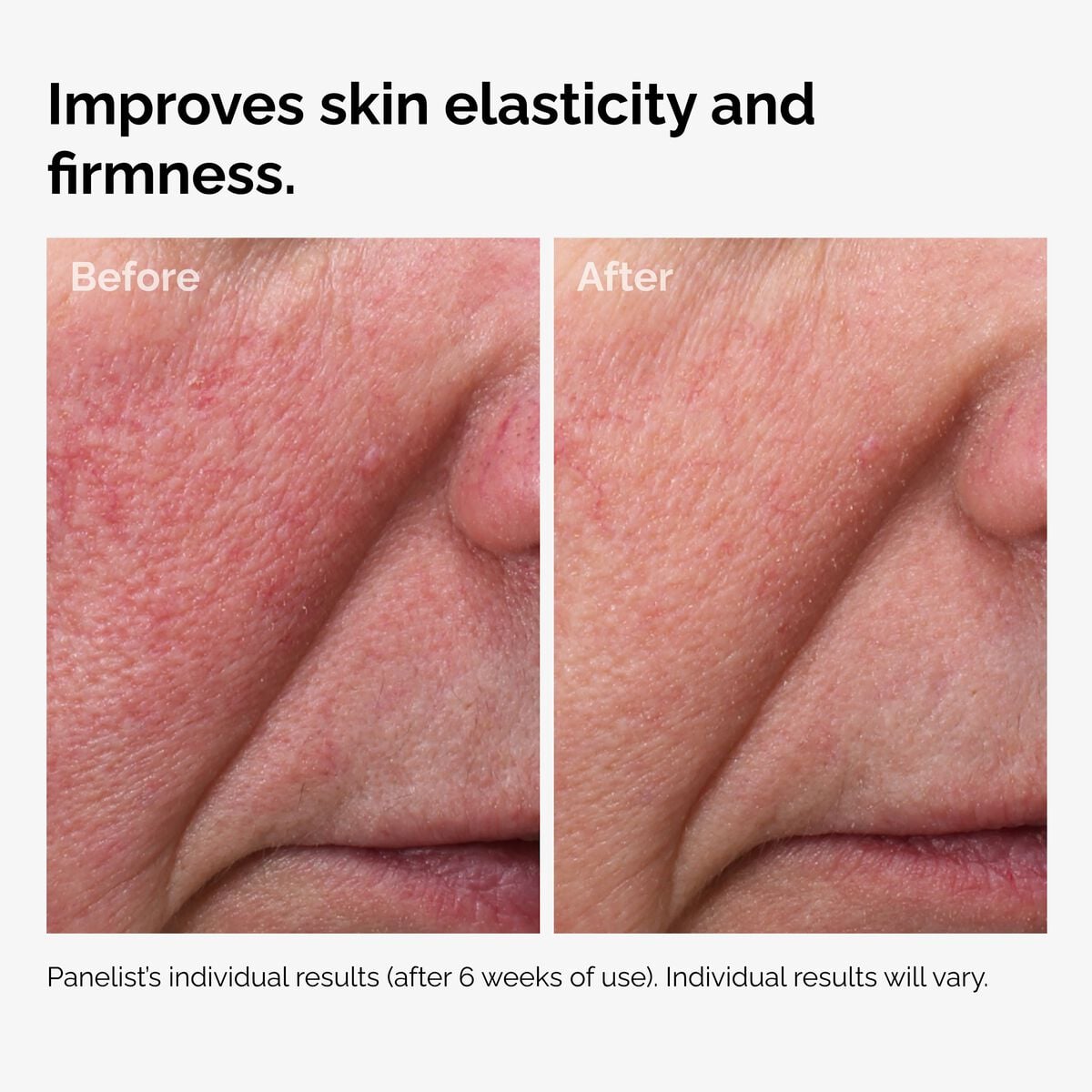100% Fermented Rose Hip Seed Facial Oil