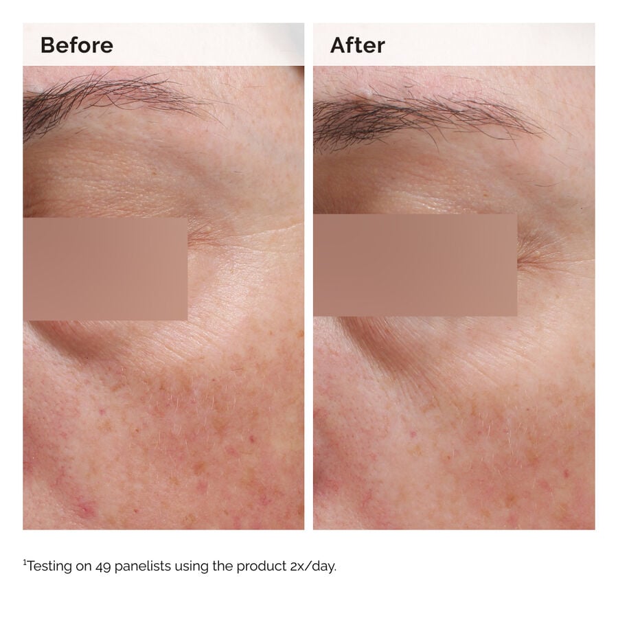Niacinamide 5% Face and Body Emulsion